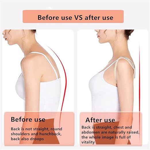 Posture Corrector for Women and Men,Breathable Hunchback Corrector,Adjustable Back Straightener Brace Suitable for Back,Shoulder and Spine Pain Relief(Beige,XS)