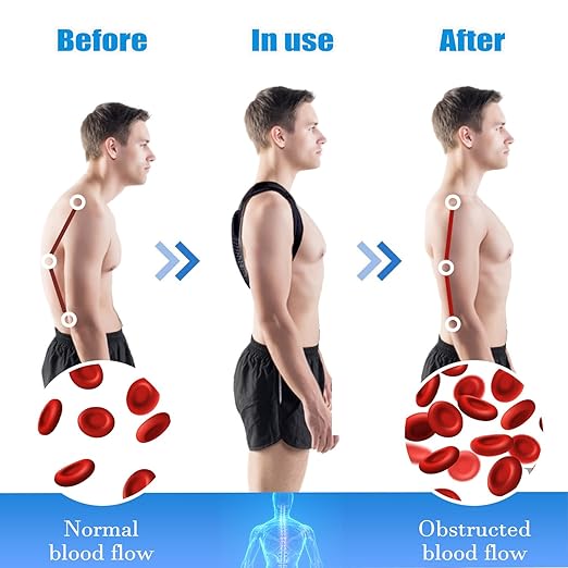 Posture Corrector Brace, Adjustable Back Support for Women and Men (Medium(105-143 LB))
