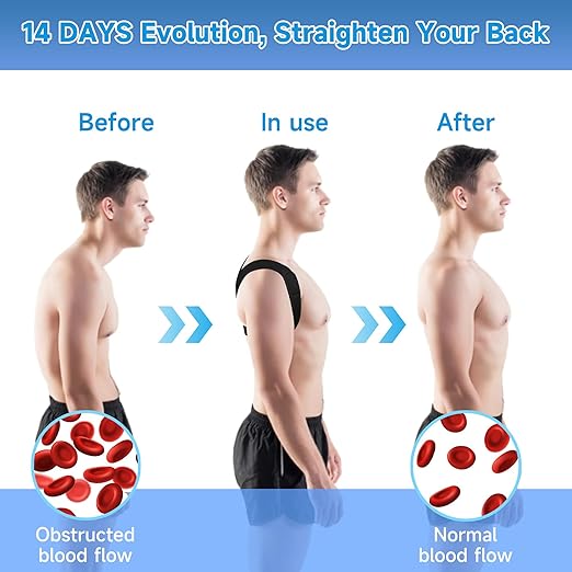 Back Straightener Posture Corrector for Women and Men, Adjustable Back Posture Corrector for Back Support, Upper Back Brace Shoulder Straightener for Women, Black M