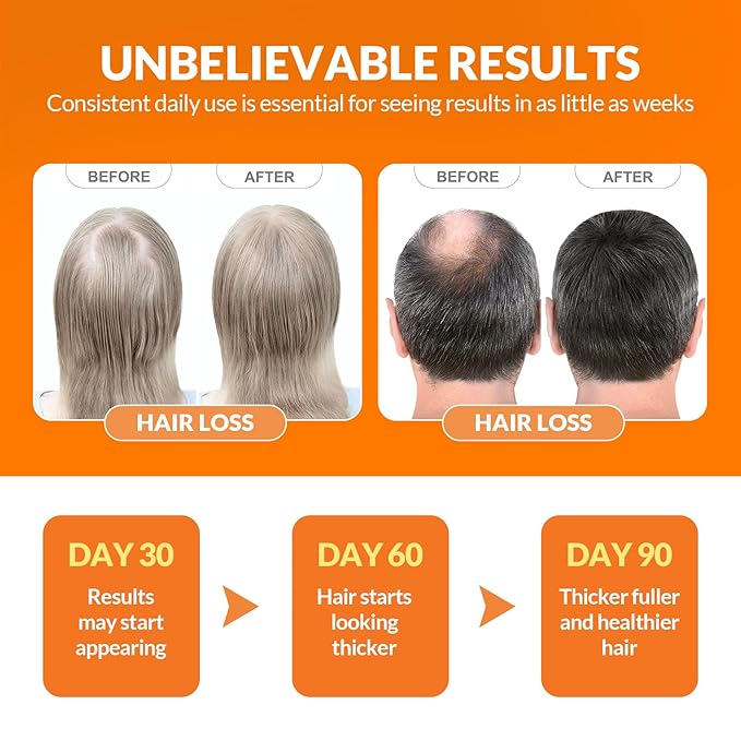 Batana Oil for Hair Growth Dr Sebi - 4-in-1 100% Pure & UnrefinedHonduran Oil with Rosemary, Castor,Nourishes, Enhances Hair Thickness, Prevents Loss, Eliminates Split Endsfor All Hair Types (100ML)